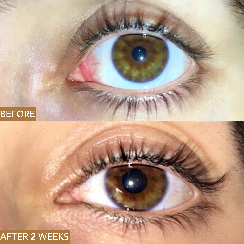 Moon Boost Lash & Brow Enhancing Serum