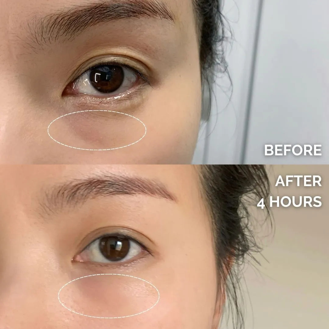Chiron Microcrystalline Deep Penetration Eye Mask