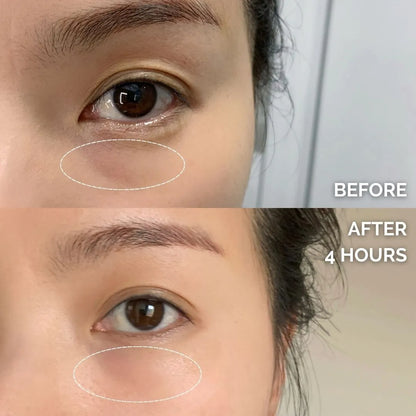 Chiron Microcrystalline Deep Penetration Eye Mask