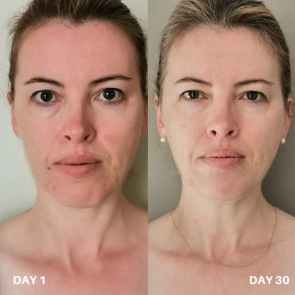 Skin Purifier Spray