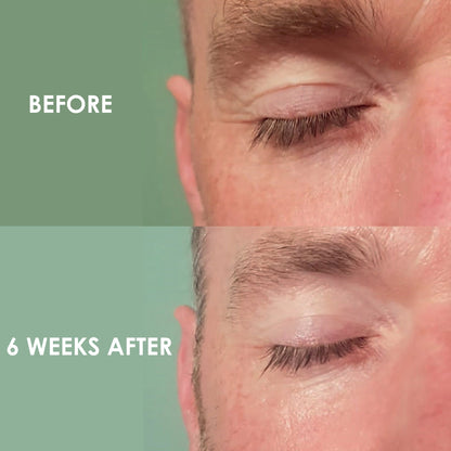 Eye Restore
