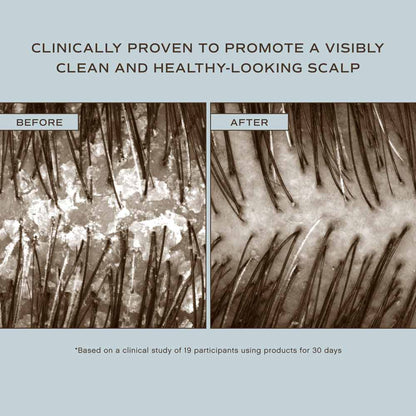 Hair Renew Scalp Conditioner