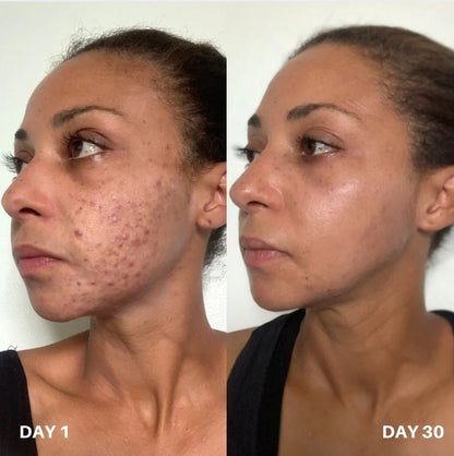 Skin Purifier Spray