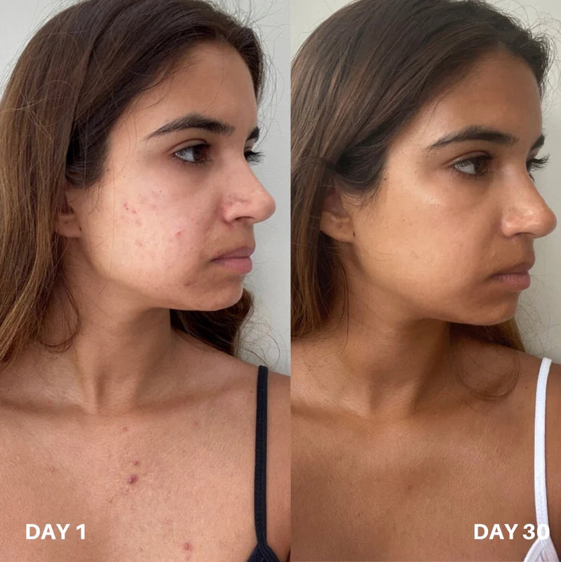Skin Purifier Spray