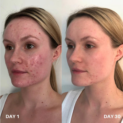 Skin Purifier Spray