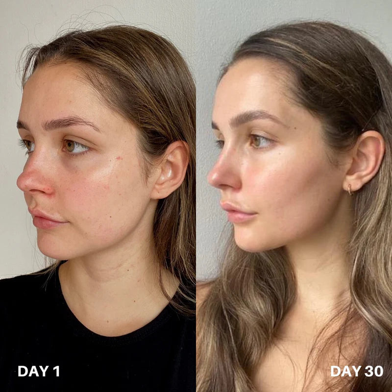 Skin Purifier Spray
