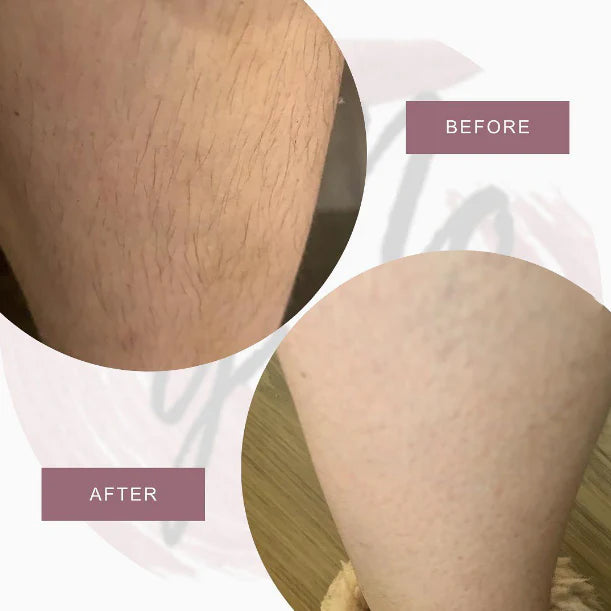 Female Body Hair Remover & Growth Inhibitor