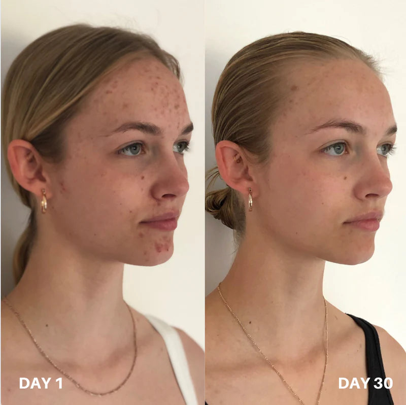 Skin Purifier Spray