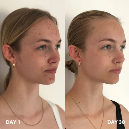 Skin Purifier Spray
