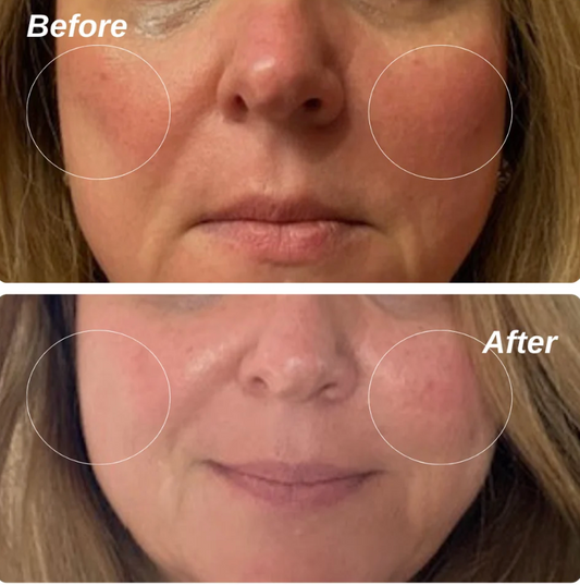Ruddi - 5% Vita C + Ceramides for Sensitive Skin