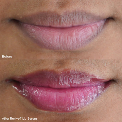 Lip Serum