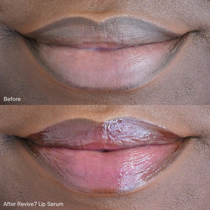 Lip Serum