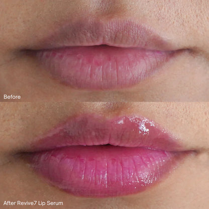 Lip Serum