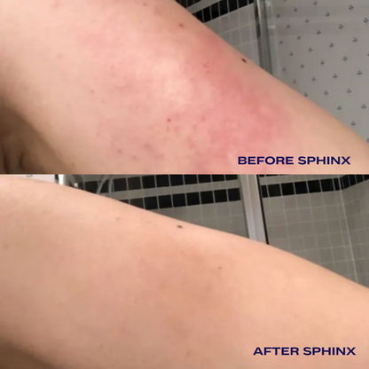Sphinx Body Oil For Eczema And Rosacea Relief
