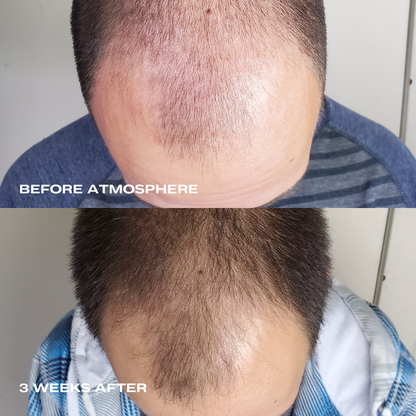 Atmosphere Multi-Peptide Hair Density & Scalp Serum