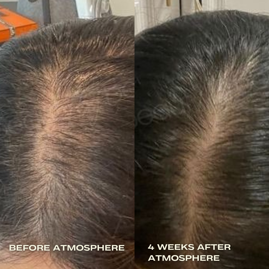 Atmosphere Multi-Peptide Hair Density & Scalp Serum